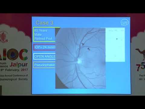 Vineet Ratra AIOC2017 - IC505 - Dr. Vineet Ratra (17.02.2017 / 09:00-10:25 / HALL: H ...