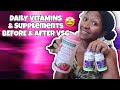 VSG Journey | EVERYTHING YOU NEED TO KNOW ABOUT VITAMINS AFTER VSG!