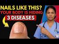 Doctor Explains: If Your NAILS Look Like THIS After 65, Your Body Can be Hiding 3 Diseases