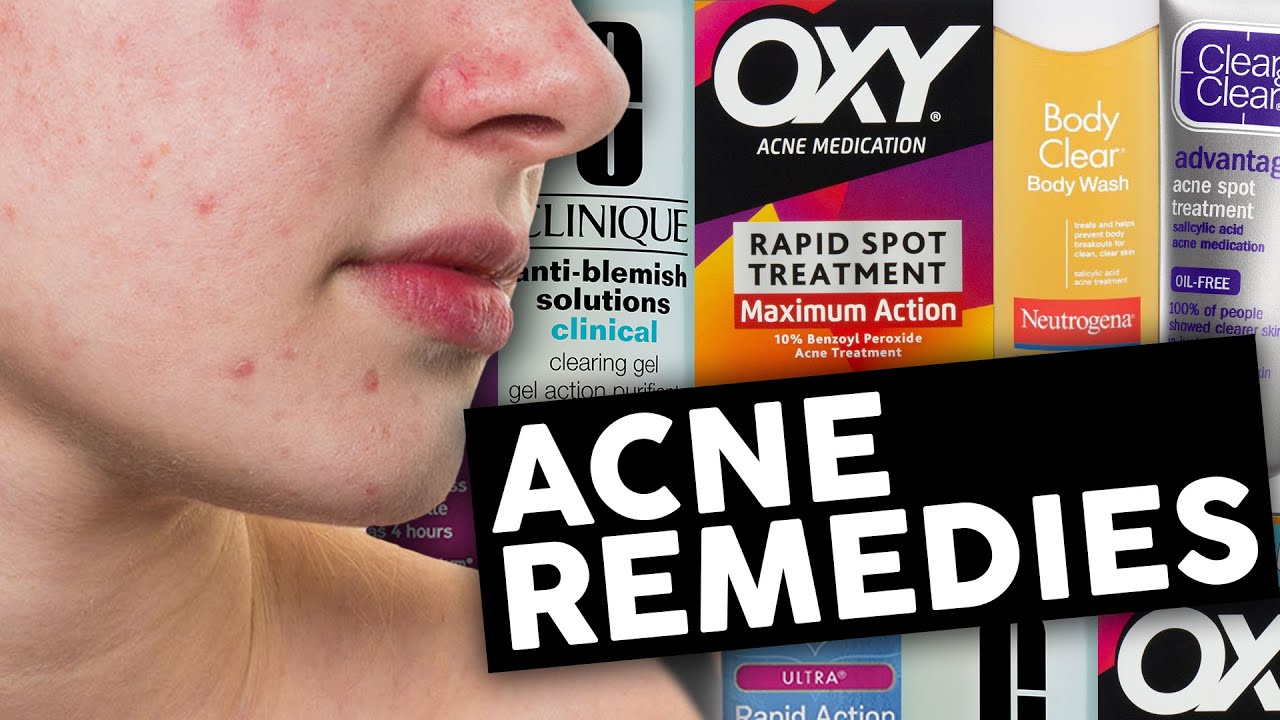 4 BEST Acne Treatments That Actually Work (LISTED) - YouTube