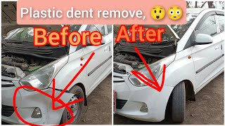 Hyundai Eon Plastic Dent Remove #Hyundai by jeetu car care 4,668 views 2 years ago 3 minutes, 13 seconds