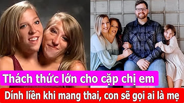 Chị em song sinh dính liền tuyên bố mang thai: Hai người chung một cơ thể, con sẽ gọi ai là mẹ?