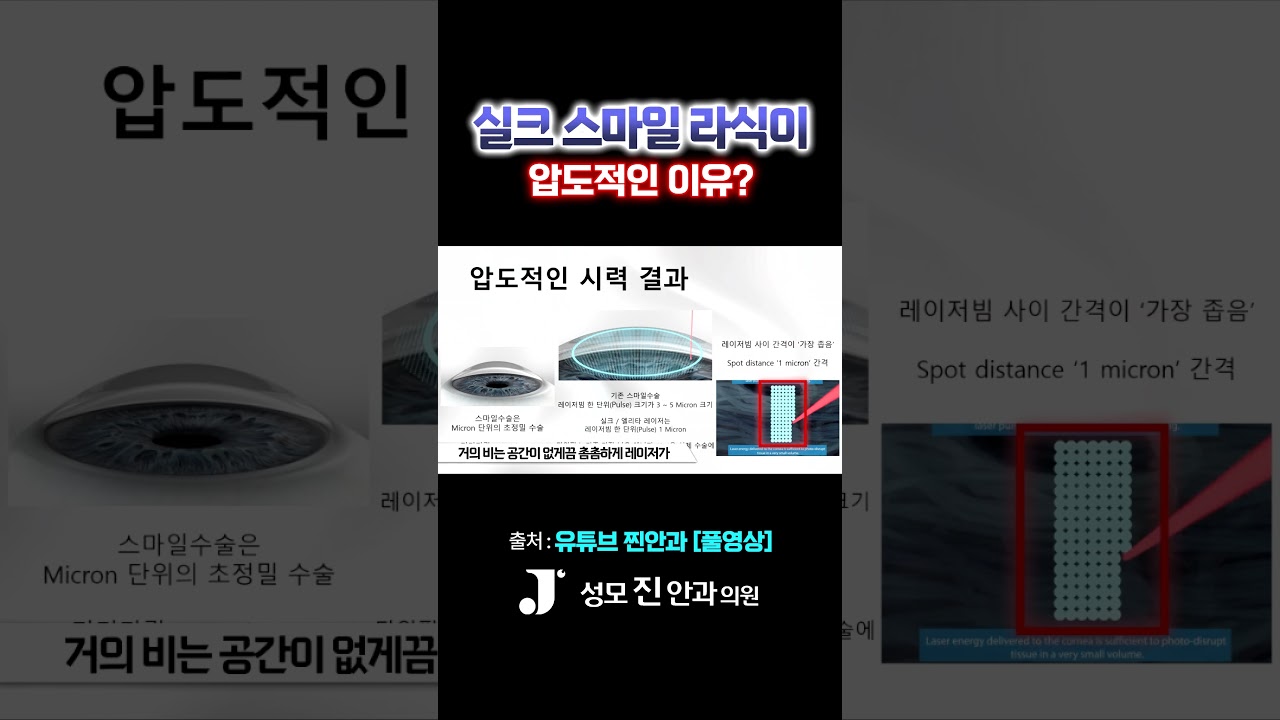 [Сонможин Нүдний Эмнэлэг] Мэс заслын дараа ямар ч хязгаарлалтгүй Торго Смайл ЛАСИК мэс засал! #СонможинНүднийЭмнэлэг #НүднийЭмч #СмайлЛАСИК