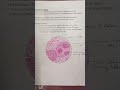 #SCHWANNOMA