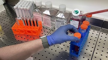 Peripheral Blood Mononuclear Cells: Isolation, Freezing, Thawing, and Culture. Part I