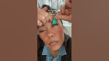 How to get rid of styes #stye #eyecaretips #eyecare #eyedoctor