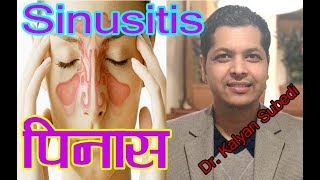 पिनास (sinusitis) बारेमा Presentation by Dr. Kalyan Subedi