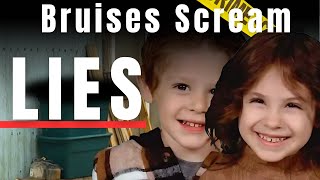 💥 Bruises and Lies: The Dark Truth Behind Lilly and Jack’s Vanishing 💥