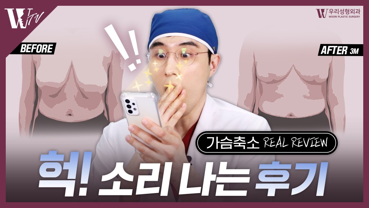 가슴축소술 실제 환자 후기