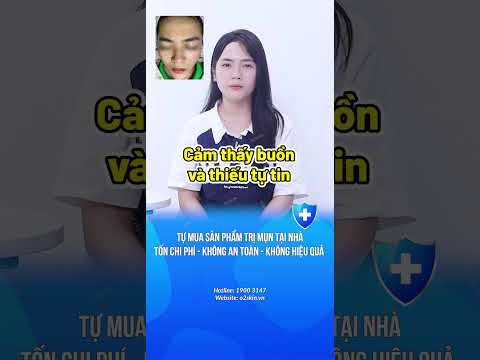 TỰ MUA SẢN PHẨM TRỊ MỤN TẠI NHÀ TỐN CHI PHÍ – KHÔNG AN TOÀN – KHÔNG HIỆU QUẢ  #o2skin #trimun 2023 mới nhất