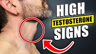 8 Signs You have HIGH Testosterone Levels! (UNDER 35 yrs Old)