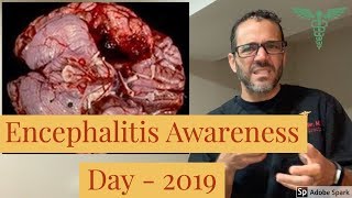 Encephalitis Day February 22, 2019 - DrER.tv