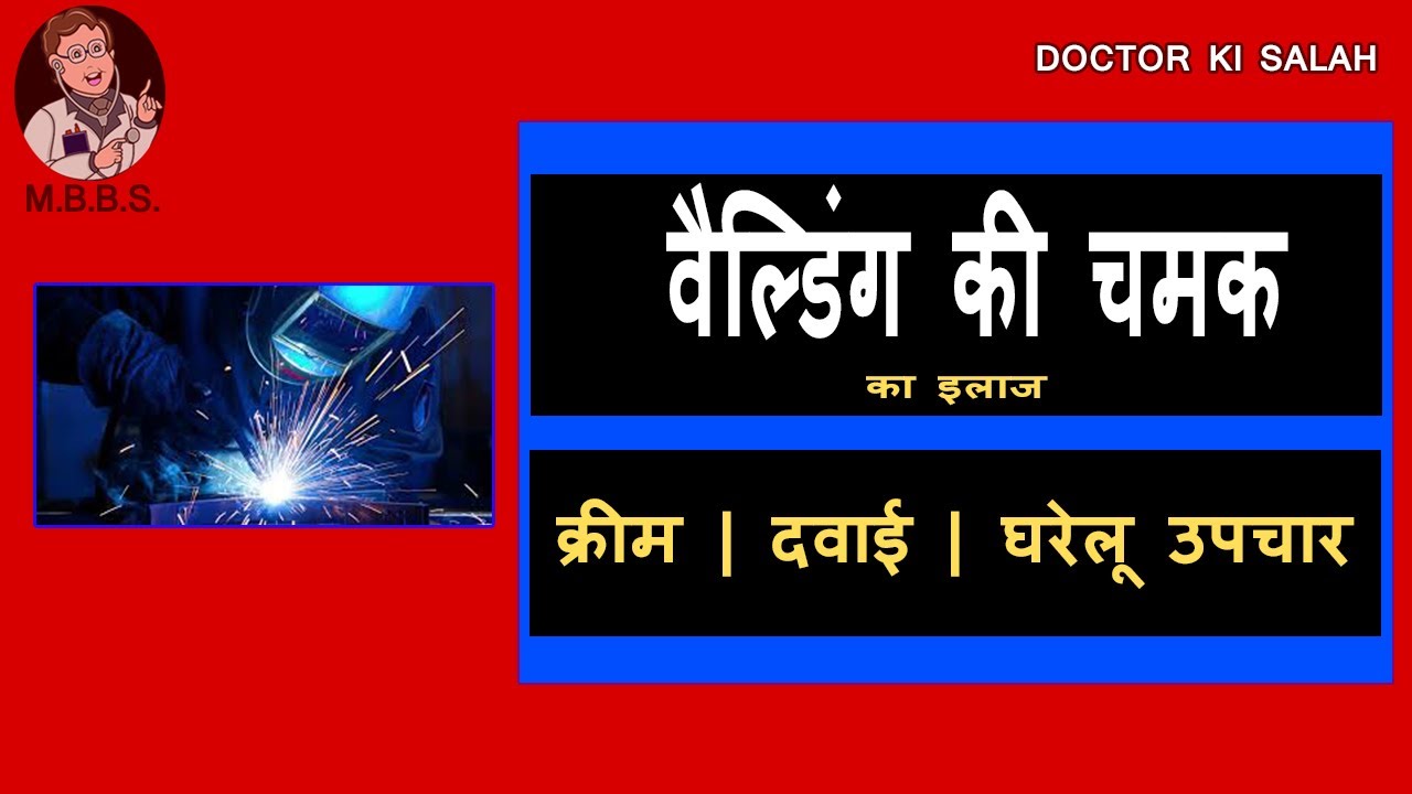 वेल्डिंग लाइट लगने पर क्या करे Welder Flash Burn Eye Drops Home