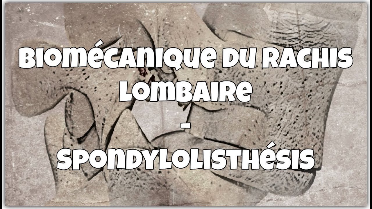 video phone beyonce mp3 Biomécanique du rachis lombaire - Spondylolisthésis