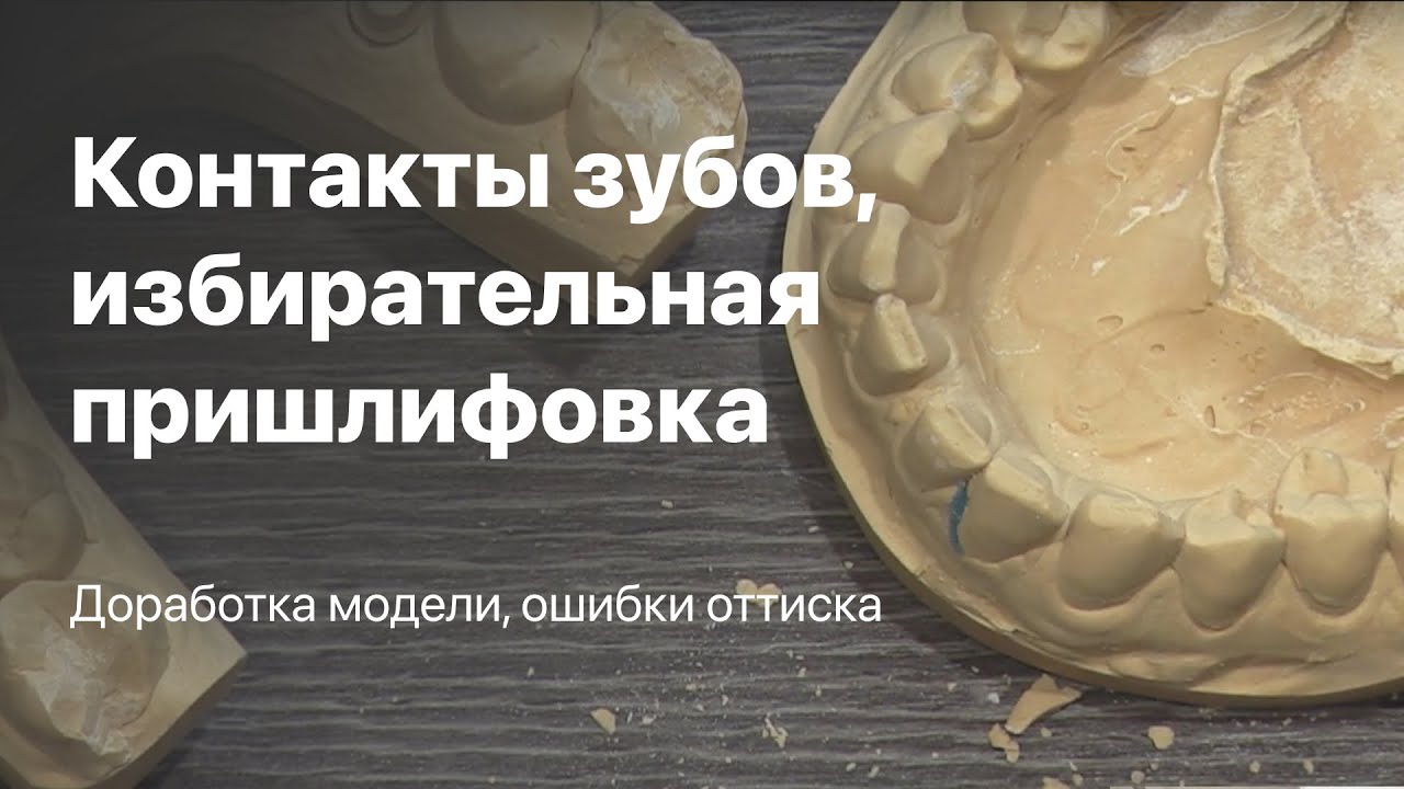 Контакты зубов, избирательная пришлифовка зубов, окклюзия и прикус. Доработка модели ошибки оттиска
