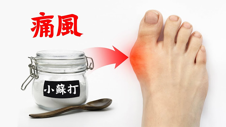 痛風最佳的自然療法,柏格醫生 Dr Berg - 天天要聞