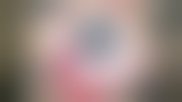 DMEK tips and tricks - "F" marking for correct orientation