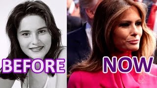Melania #TRUMP. BEFORE and NOW