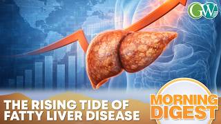 Nearly 2 Billion To Have Metabolic Liver Disease By 2050 Study