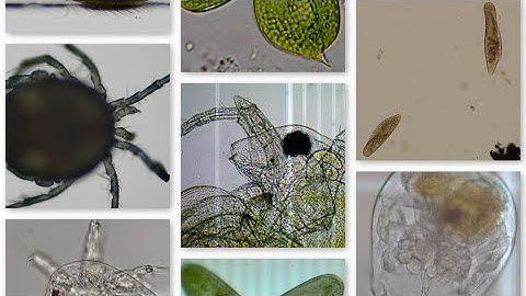 Algae Corner: Microscope Creatures