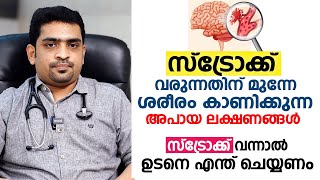 സ്ട്രോക്ക് എങ്ങനെ നേരത്തെ തിരിച്ചറിയാം ? Stroke Malayalam | Arogyam