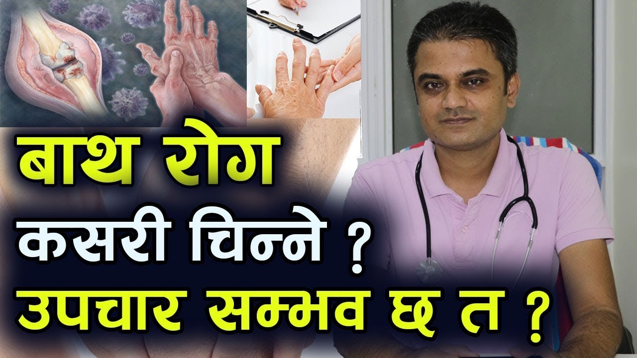 Bath Rog के हो, लक्षण कस्तो हुन्छ, उपचार सम्भव छ ? Rheumatoid Arthritis | Dr Ram Krishna Giri