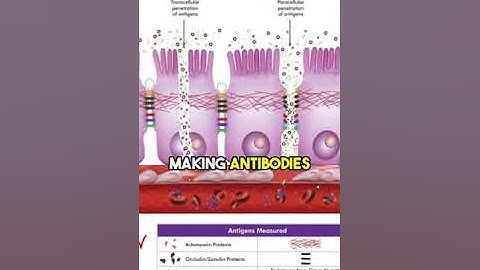Understanding Leaky Gut Testing