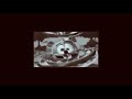 YTPMV Gummy Bear All Colors Slow Scan