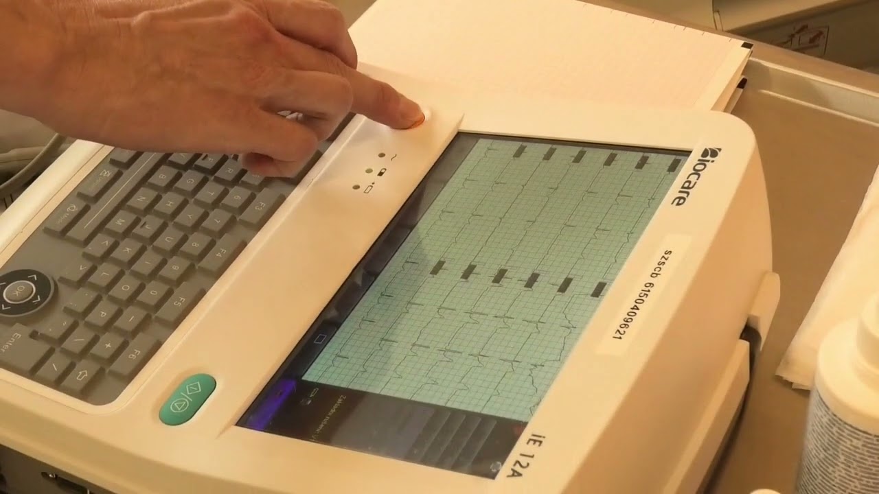 63 -  Jednorázové klidové EKG - standardní