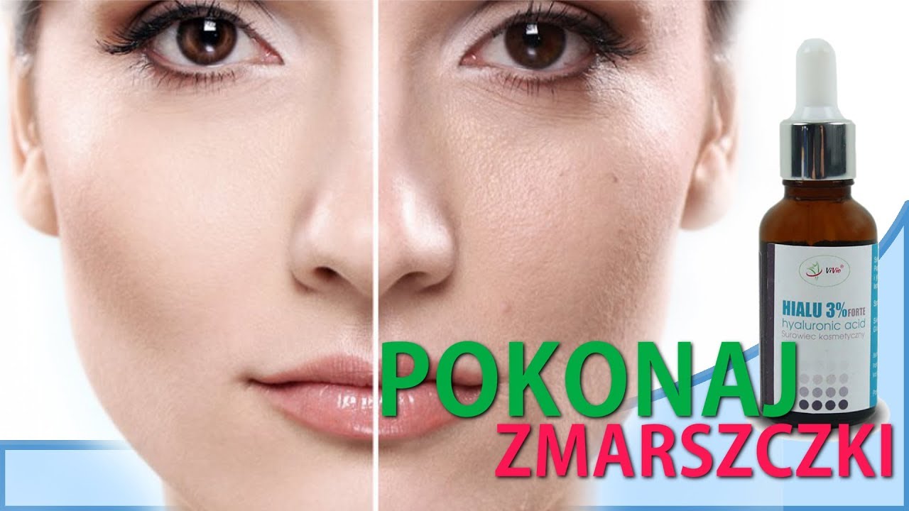 馃pokonaj Zmarszczki馃檯 馃敟kwas Hialuronowy 3 Innowacja W Piel臋gnacji Sk贸ry I W艂os贸w Youtube