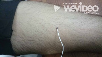 Temperature measurement of skin using LabView on NI ELVIS II SERIES.