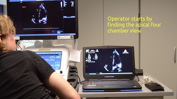 Real-time automatic ejection fraction and foreshortening detection using deep learning