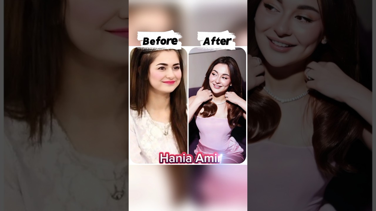After Cosmetics Surgery 🎭 Pakistani Actress 