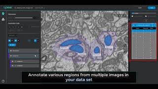 Guidelines for partial annotations on arivis Cloud (formerly APEER)
