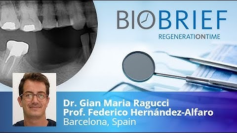 Combined horizontal and vertical regeneration using CAD-CAM titanium scaffold