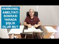 Varikosel Ameliyatına Bağlı Yarada Şişlik Olacak mı?