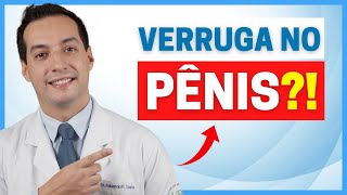 CINCO CAUSAS DE VERRUGAS NO PÊNIS E COMO TRATA-LAS!