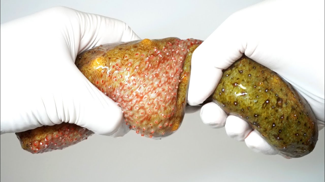 the extraordinary special ability of sea slugs - YouTube