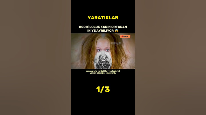 800 Kiloluk Kadın Herkesi Şok Etti! #dizi #film #sinema