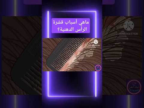 أسباب قشرة الرأس الدهنية