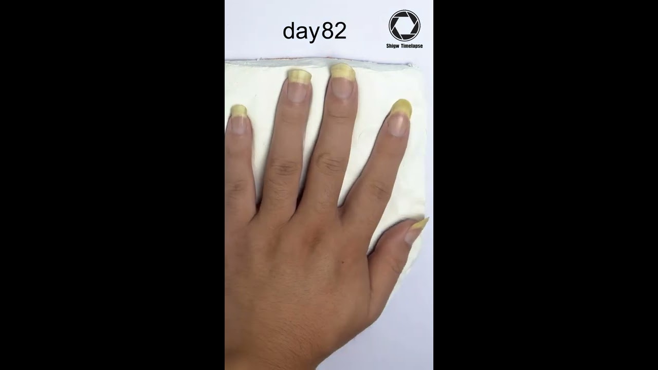 Fingernail Growing Time Lapse 90days Shorts