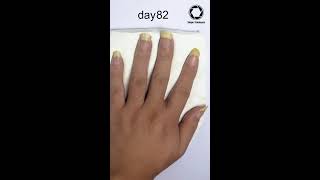 Fingernail Growing Time lapse - 90days #Shorts screenshot 5