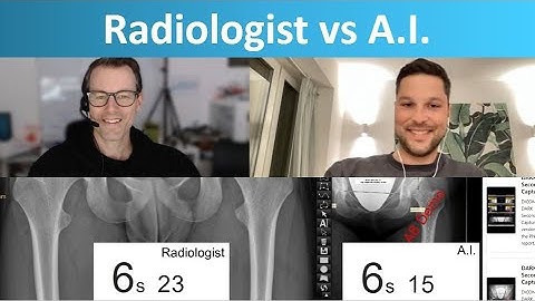 Radiologist vs. Artificial Intelligence - Hip Angle Measurement on Radiographs