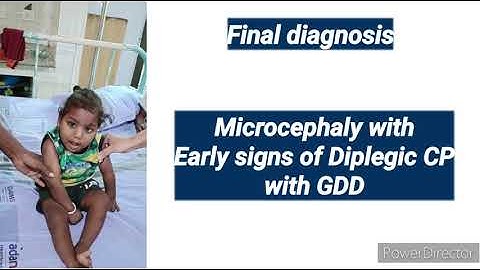 Developmental Assessment and Interpretation || Competency PE 1.7 || CBME || Pediatrics