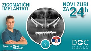 Zigomatični implantati - All on 4 tehnika - Novi zubi za 24h - Spec. dr Miloš Milošević