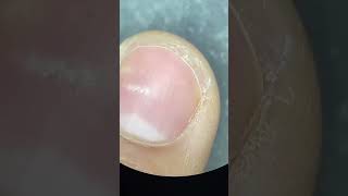 What it looks like?Human finger under a microscope(shocking).#finger #health #microscope