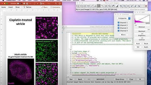 ImageJ Macro Cell Counter Instructional Video