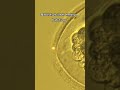human embryo natural vs laser hatching