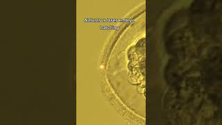 human embryo natural vs laser hatching