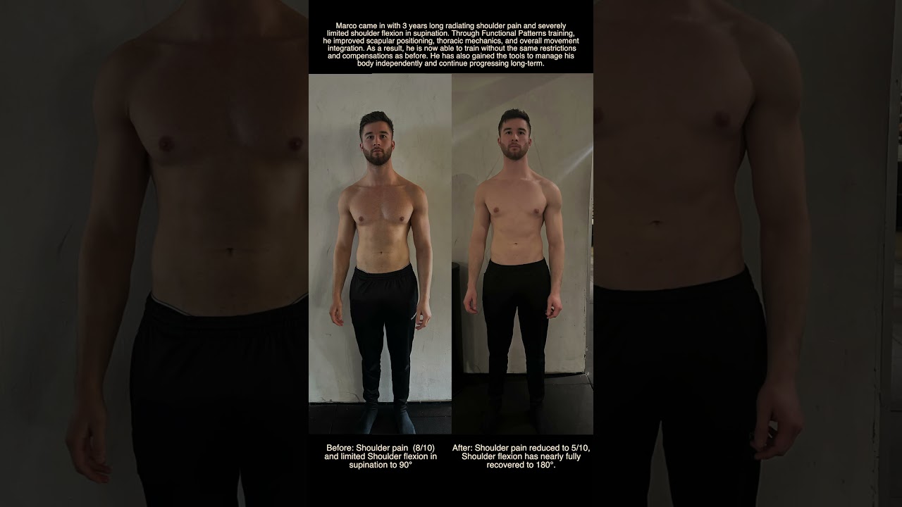 Marco før og efter 11 Functional Patterns sessioner — skulder i supination fra skulderhøjde til fuldt overhead